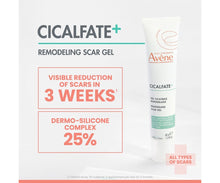Load image into Gallery viewer, Cicalfate+ Remodeling Scar Gel