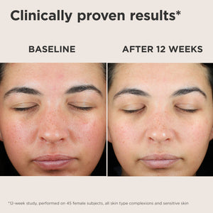 EltaMD UV Skin Recovery Red Color Correcting Green Tint Broad Spectrum SPF 50